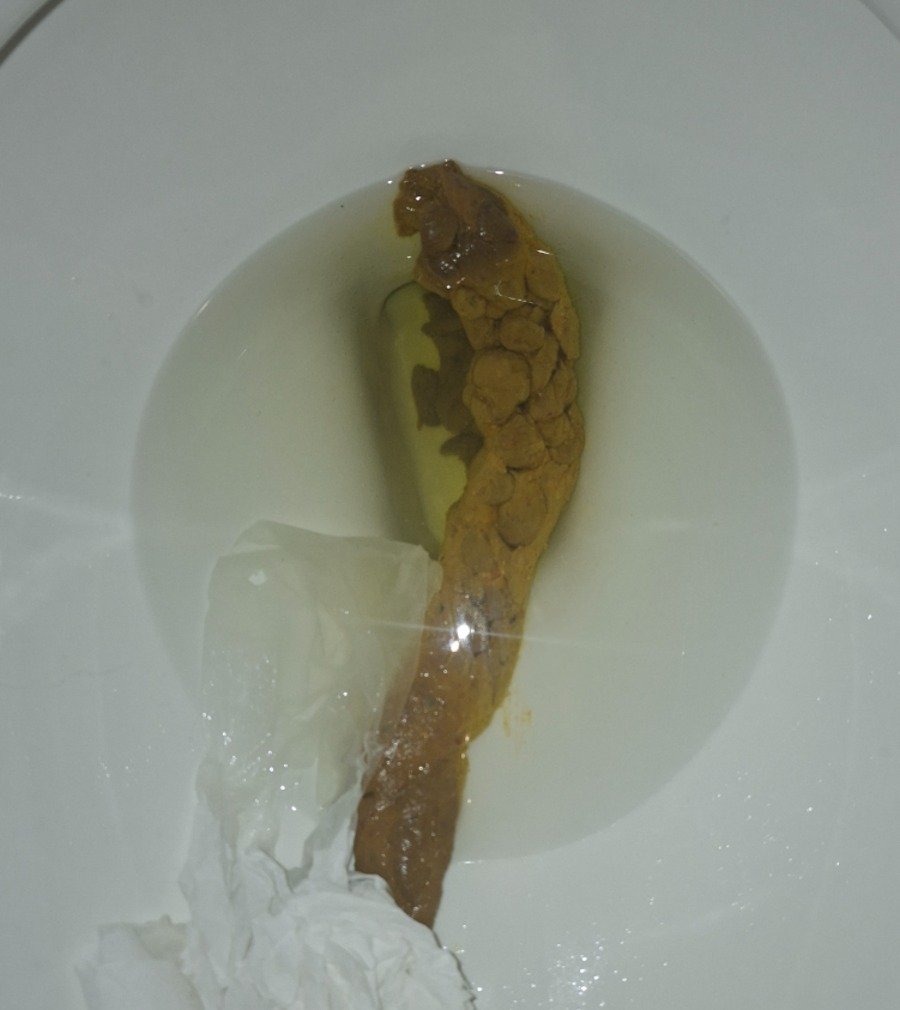 Full Epic Log